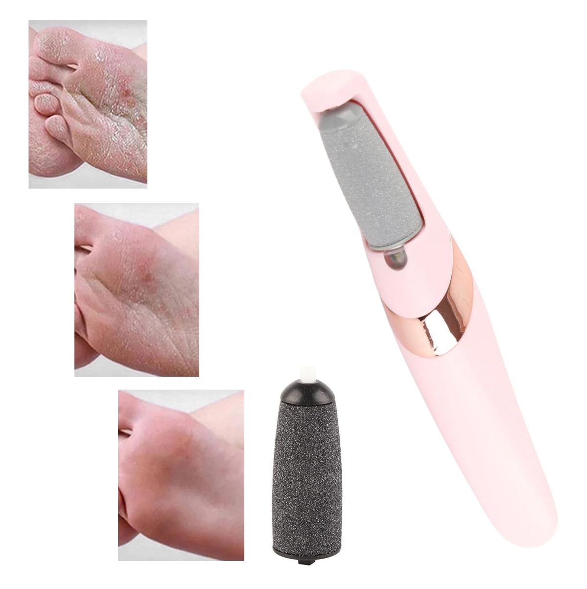 Miniatura 3 de Lima Removedor Quita Callos Electrico